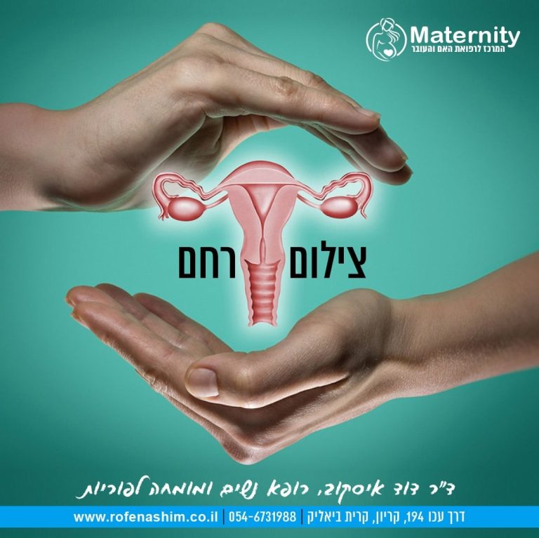 צילום רחם פרטי - מחיר ובדיקת סונוהיסטרוגרפיה | ד